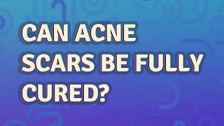 Can acne scars be fully cured?