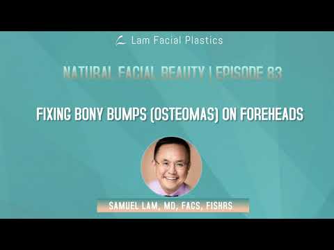 Dallas Cosmetic Surgery Podcast: Fixing Bony Bumps (Osteomas) on Forehead