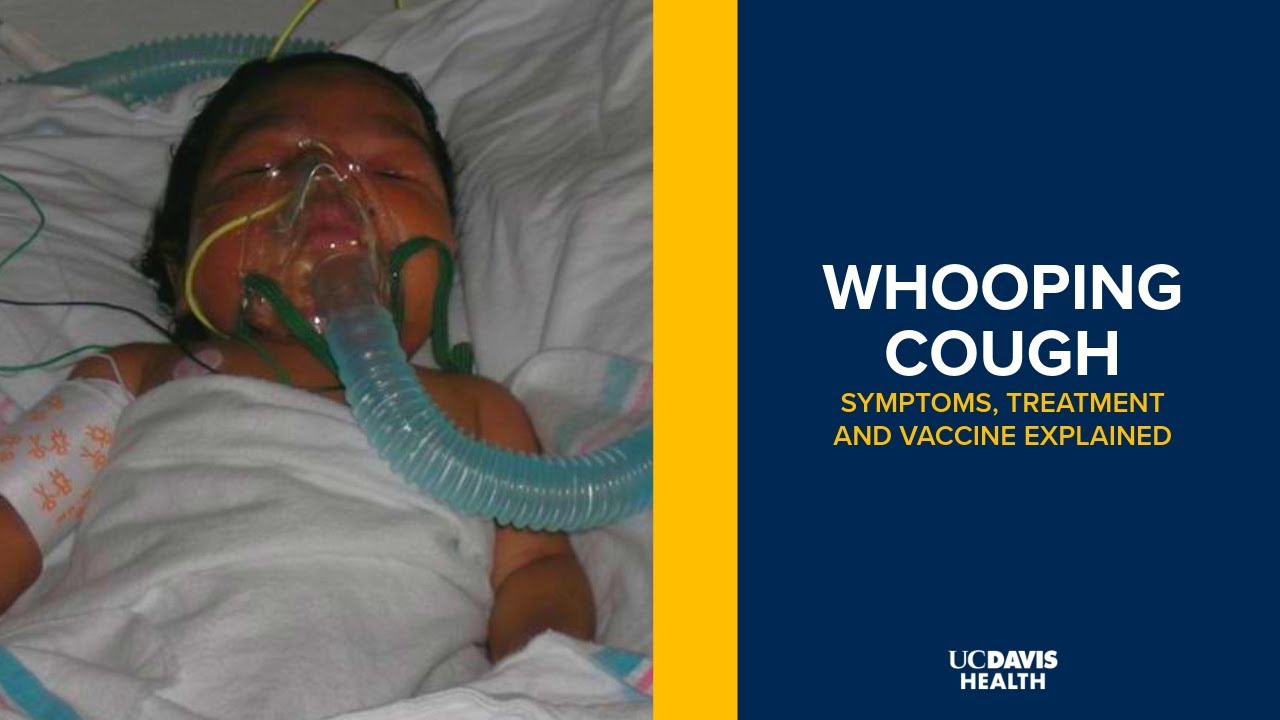 Thumbnail preview of Whooping Cough (Pertussis) Diagnosis, Symptoms and Treatment