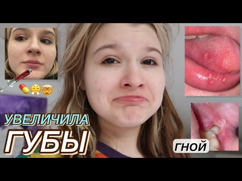 как я УВЕЛИЧИЛА ГУБЫ ;)