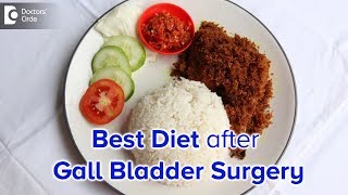 Diet after Laparoscopic Cholecystectomy Gall bladder surgery - Dr. Nanda Rajaneesh