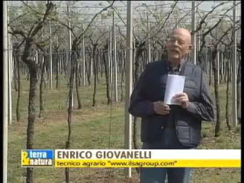 Chirurgia artrodesi della caviglia Di questo dolori articolari