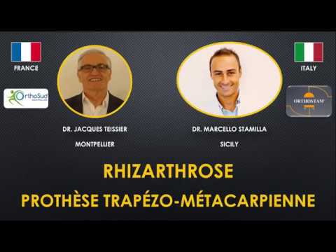 RHIZARTHROSE : LA PROTHESE DU POUCE EN CAS D’ARTHROSE A LA MAIN by Dr. Teissier & Dr. Stamilla