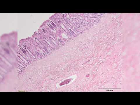 MINT-Workshops mit Christine - HSKL kennenlernen