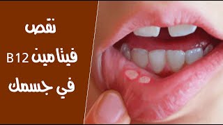 علامات تحذيرية 