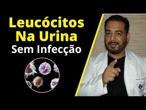 Leucócitos na urina (leucocitúria) sem infecção: o que pode ser? | Exame de Urina Tipo 1 (EAS)