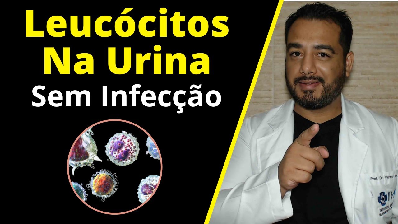 Leucócitos na urina (leucocitúria) sem infecção: o que pode ser? | Exame de Urina Tipo 1 (EAS)