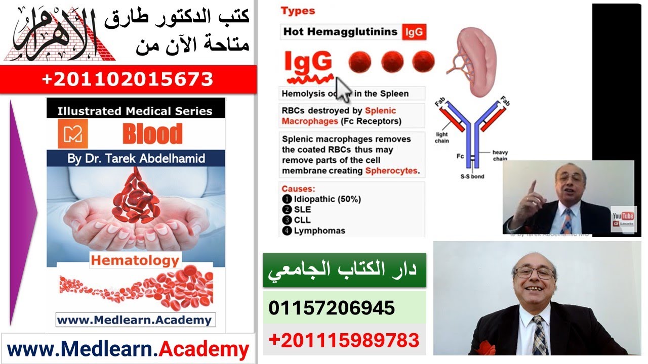 Autoimmune Hemolytic Anemia  #cme #internal_medicine #medical #usmle #محاضرات_باطنة #USMLE