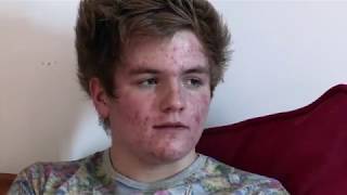 ROACCUTANE (dying for clear skin)