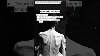 Anorexia nervosa