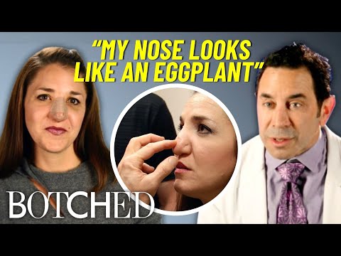 Margo’s Nose Won’t Stop Getting BIGGER After A Botched Nose Job At 15   | Botched | E!