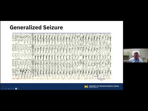 Neuromodulation for Epilepsy