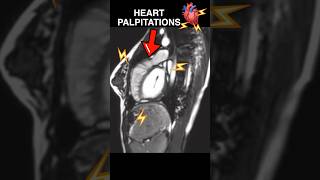 Download lagu Jantung berdebar-debar di bawah MRI🫀⚡️ #kecemasan #kardiologi mp3