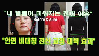 [골반교정/얼굴비대칭] 거울 볼 때마다 스트레스? 진짜 원인은 '얼굴'이 아닙니다
