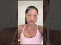 Healing Eczema Isn T About The Creams You Use Eczema Guthealth Tsw Topicalsteroidwithdrawal