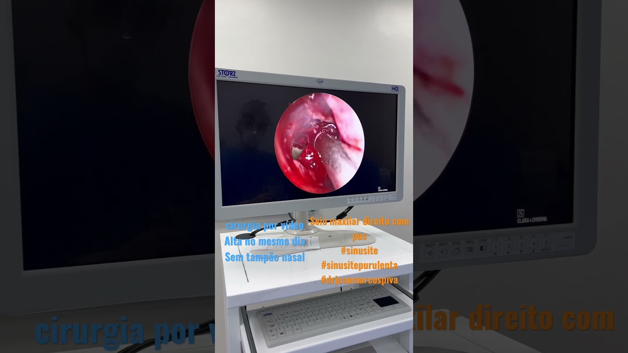 João Marcos Piva Rodrigues-23