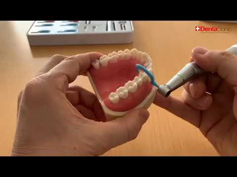 Vantaggi del sistema per lo Stripping DentaSonic