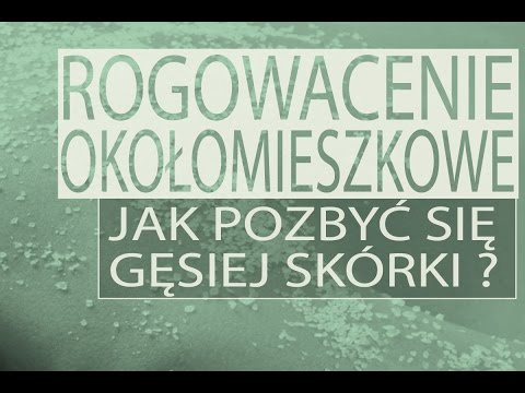 Hormony i wypadanie włosów Witaminy na wypadanie włosów jest przydatna przez