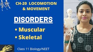 Ch-20 Locomotion and movement - Disorders of muscular & skeletal systems | Class 11 Biology/NEET