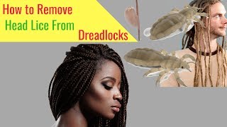How to Remove Head Lice From Dreadlocks