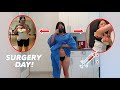 SHE GOT HER BODY DONE SURGERY DAY