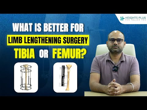 Femur vs Tibia Lengthening – Which Option is Better for You? | Heights Plus