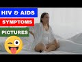 HIV AIDS symptoms (9 facts)