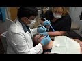 The Only Dental Relief For Many In This West Virginia County Is Extraction