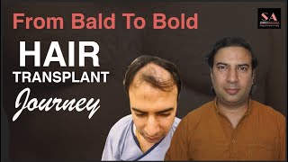 Hair Transplant Patient Testimonial | Mr. Ravi Shared his Beautiful Journey After Hair Transplant