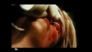 Chemlab - Blunt Force Trauma - (Gore video)