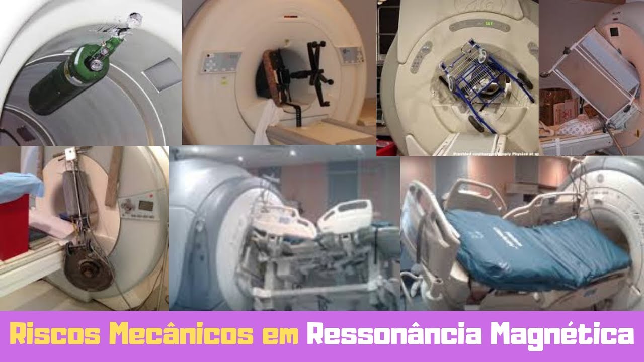 Acidentes de natureza mecânica em ressonância nuclear magnética - MRI accidents