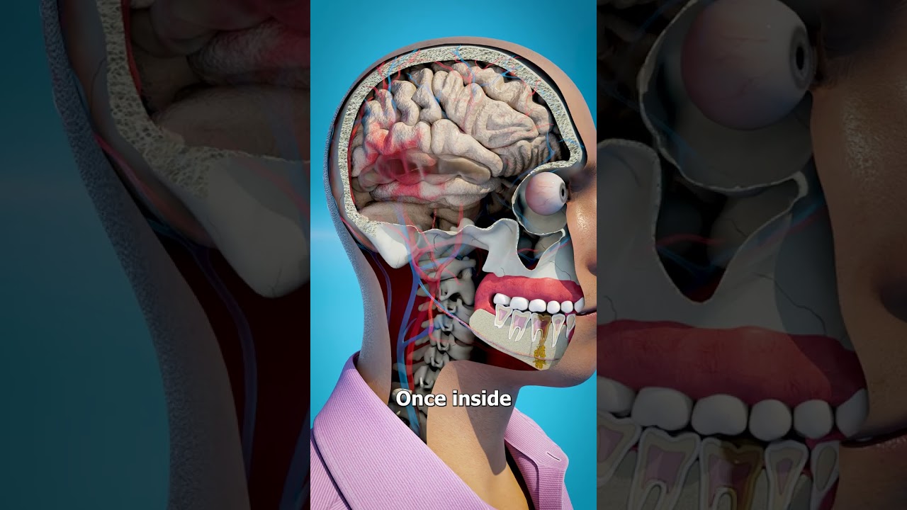 How A Tooth Can Kill You 😱