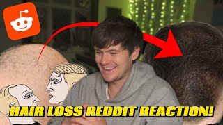Reacting to HAIR LOSS REDDIT! (Tressless)