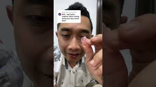 Download lagu DO VALPLAST DENTURES REALLY MAKE BONES SHRINK? #valplastdentures #dentures mp3