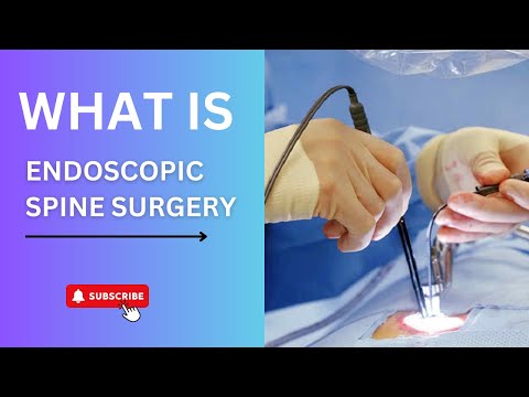 What is Endoscopic Spine Surgery | Myths & Facts | Dr. Ajay Kothari