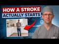 Seniors, THIS is HOW a Stroke Looks Like the Day Before It Hits — Know This to Protect Yourself