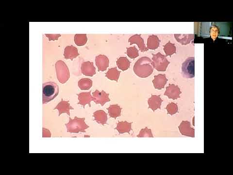 Alterações eritrocitárias aula