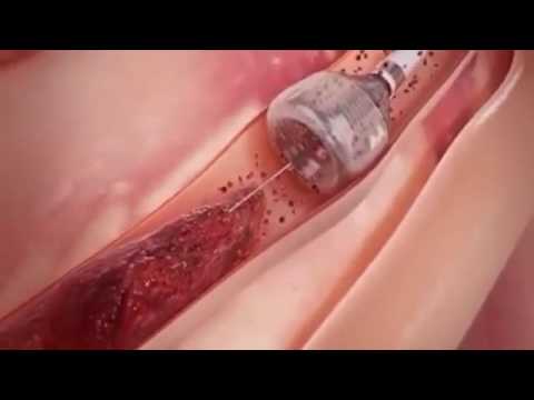 Susu kambing dengan potensi yang Apa efek salep untuk pembesaran penis