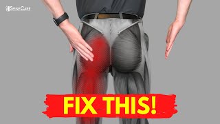 The QUICKEST Way to Get Sciatic Leg Pain Relief