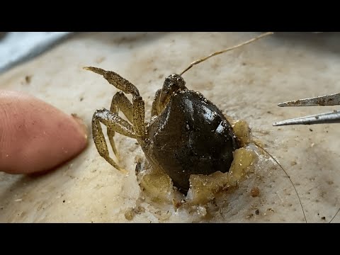 🔴 Professional DR LEE’S ULTIMATE ZITPOPPER Sharp Ingrown Trimmed ✧ 0063