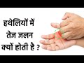 हथेलियों में तेज जलन होने की असली वजह �
