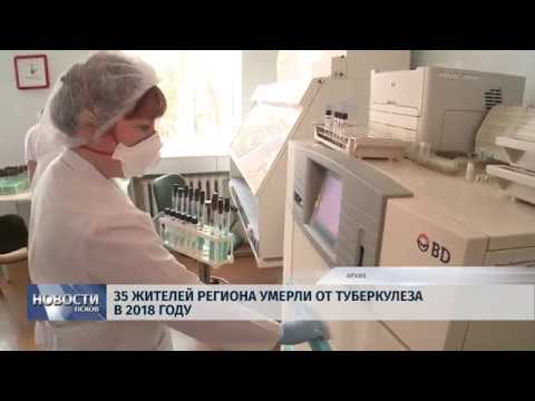 Новости Псков 23.10.2018 # Тридцать пять жителей региона умерли от туберкулеза в 2018 году