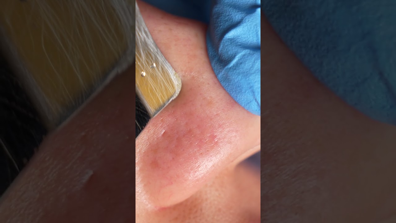 Facial  thumbnail