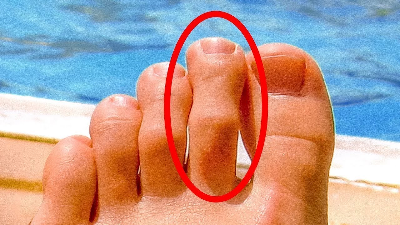 8 SINAIS DE QUE O SEU CORPO ESTÁ PEDINDO AJUDA