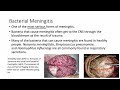 Intro To Microbiology Microbial Diseases Of The Nervous System