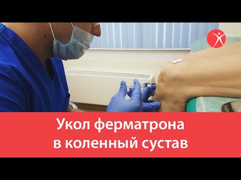 Йога при остеохондрозе упражнения Брусника от боли в суставах