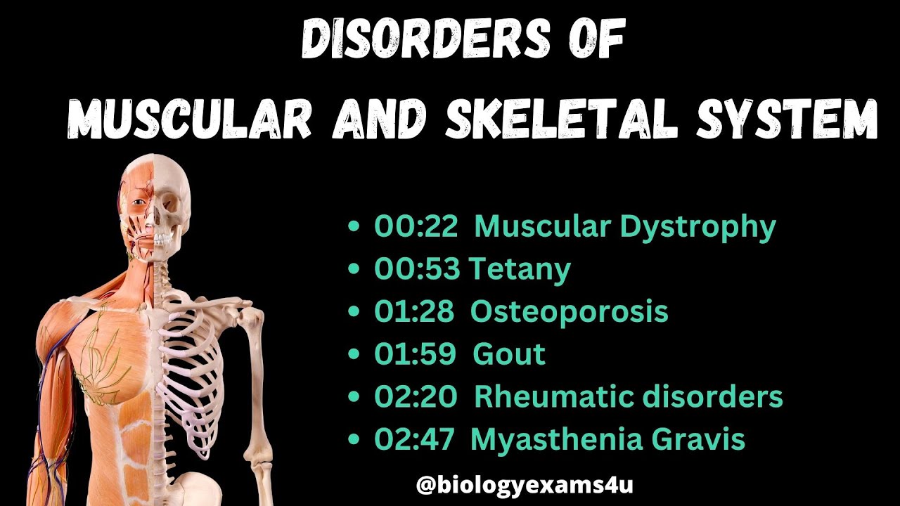 Disorders of Muscular and Skeletal System | Human Physiology
