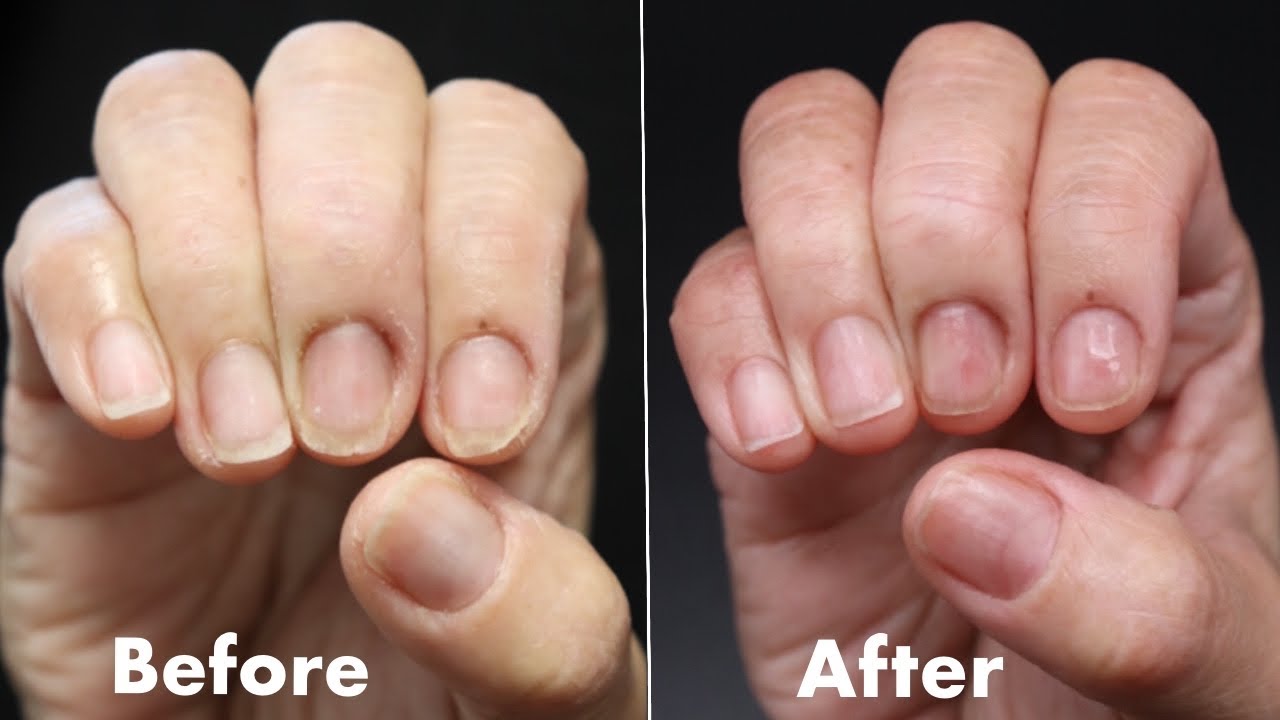 How To Fix DAMAGED, THIN & BRITTLE NAILS!!! ***NATURAL NAIL STRENGTHENING TREATMENT***