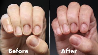 How To Fix DAMAGED, THIN & BRITTLE NAILS!!! ***NATURAL NAIL STRENGTHENING TREATMENT***