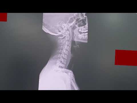 Lil Aungpao x Artrilla - ก่อนไป (Prod. NextLane)